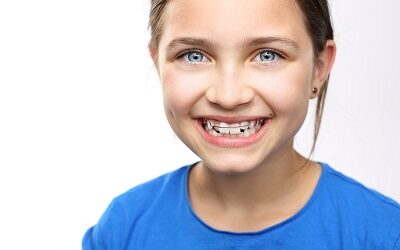 The Many Benefits Of Wearing A Retainer